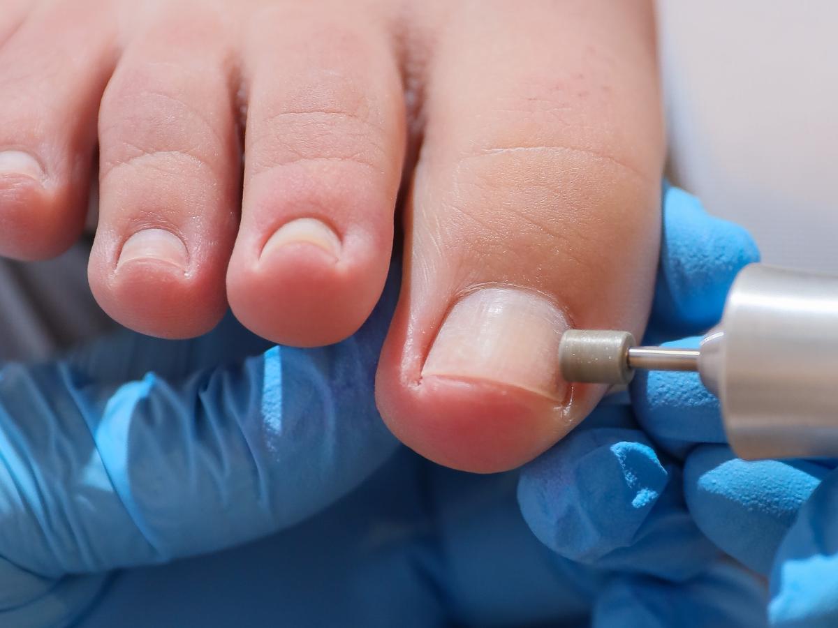 Nagelpflege mit Fräser